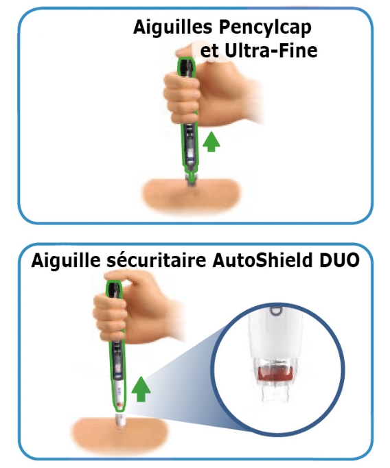 Image d’une main tenant le stylo injecteur à un angle de 90 degrés avec le pouce appuyant sur le bouton d’injection jusqu’au bout et une flèche indiquant le sens de retrait de l’aiguille du corps